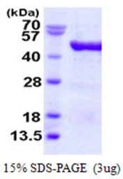 Human VAT1 protein, His tag. GTX68162-pro