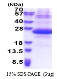 Human SSSCA1 protein, His tag. GTX68165-pro