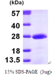 Human PMVK protein, His tag. GTX68186-pro