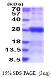 Human DCTN6 protein, His tag. GTX68187-pro