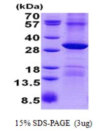 Human POP4 protein, His tag. GTX68192-pro