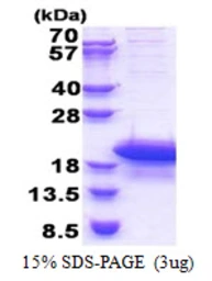 Human ARPP19 protein, His tag. GTX68193-pro