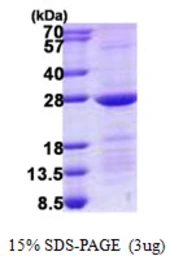 Human Rab10 protein, His tag. GTX68196-pro