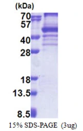 Human EBNA1BP2 protein, His tag. GTX68210-pro