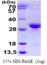 Human RAB32 protein, His tag. GTX68213-pro