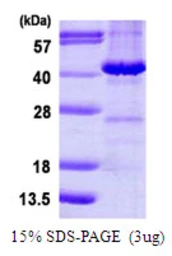 Human MAPRE2 protein, His tag. GTX68214-pro