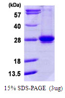 Human RAB35 protein, His tag. GTX68216-pro