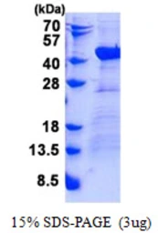 Human DNAJB4 protein, His tag. GTX68224-pro