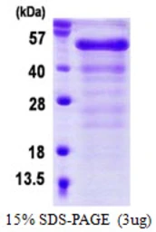Human FGFR1OP protein, His tag. GTX68226-pro