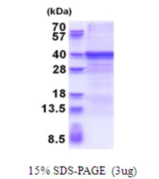Human ZWINT protein, His tag. GTX68227-pro