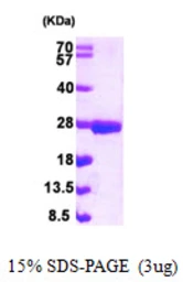 Human NUDT3 protein, His tag. GTX68232-pro