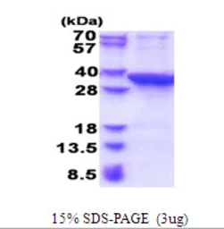 Human PROSC protein, His tag. GTX68235-pro