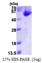 Human ACOT7 protein, His tag. GTX68246-pro