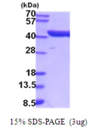 Mouse Aldolase C protein, His tag. GTX68254-pro