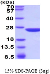 Mouse Gstp2 protein. GTX68265-pro
