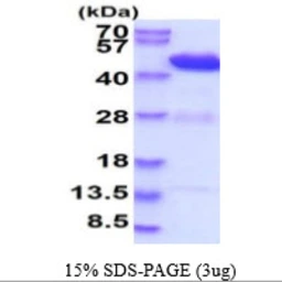Mouse HPD protein, His tag. GTX68267-pro