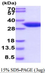 Mouse 15-PGDH protein, His tag. GTX68268-pro