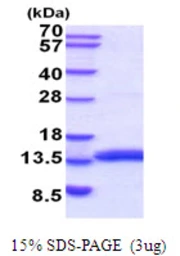 Mouse MIF protein, His tag. GTX68275-pro