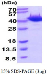 Mouse Ogg1 protein, His tag. GTX68277-pro