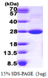 Mouse LYPLA1 protein, His tag. GTX68279-pro