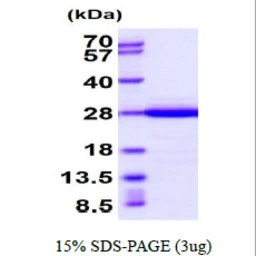 Mouse Recoverin protein, His tag. GTX68281-pro