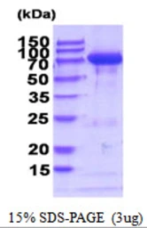 Mouse Transglutaminase 2 protein, His tag. GTX68295-pro