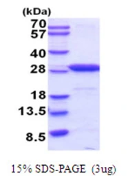 Mouse PGP9.5 protein, His tag. GTX68298-pro