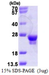 Human RAB18 protein, His tag. GTX68304-pro
