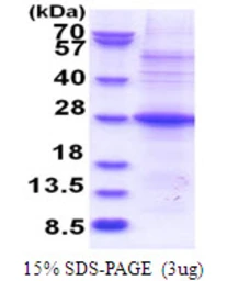 Human POMZP3 protein, His tag. GTX68305-pro