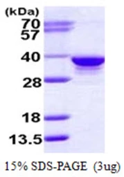 Human RPIA protein, His tag. GTX68307-pro