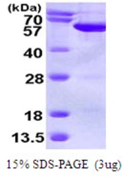 Human SEPT6 protein, His tag. GTX68314-pro