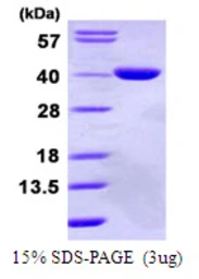 Human GPD1L protein, His tag. GTX68315-pro