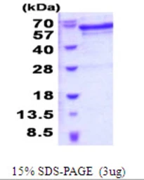 Human PSR protein, His tag. GTX68318-pro