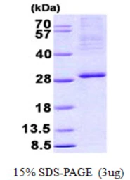 Human ITGB3BP protein, His tag. GTX68324-pro