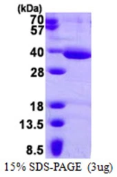 Human HAAO protein, His tag. GTX68330-pro