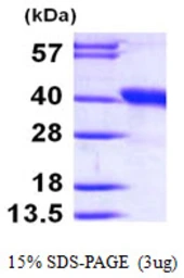 Human DDAH1 protein, His tag. GTX68337-pro