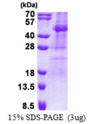 Human TSSK2 protein, His tag. GTX68342-pro