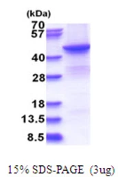 Human BHMT2 protein, His tag. GTX68347-pro