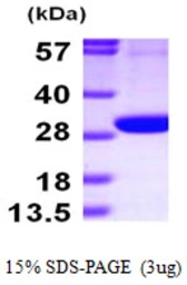 Human PGLS protein, His tag. GTX68353-pro