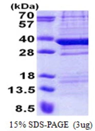Human C18orf10 protein, His tag. GTX68366-pro