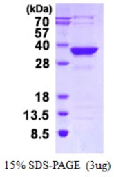 Human MMACHC protein, His tag. GTX68367-pro