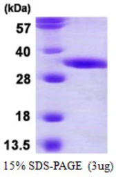Human DECR2 protein, His tag. GTX68370-pro
