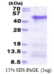 Human CCDC69 protein, His tag. GTX68371-pro