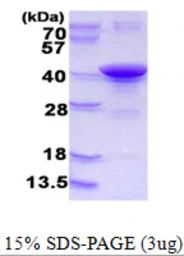 Human ARH protein, His tag. GTX68372-pro