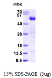 Human TES protein, His tag. GTX68373-pro