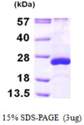 Human ARL5A protein, His tag. GTX68374-pro