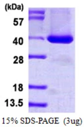 Human BRDG1 protein, His tag. GTX68375-pro