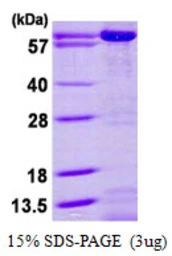 Human AK5 protein, His tag. GTX68379-pro