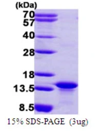 Human MYCBP protein, His tag. GTX68380-pro