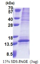 Human UQCRQ protein, His tag. GTX68390-pro